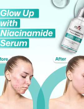 MNT 10% Niacinamide Face Serum with 0.5% Zinc, 30ml – Targets Acne Marks, Blemishes, and Uneven Skin Tone for Clearer Skin