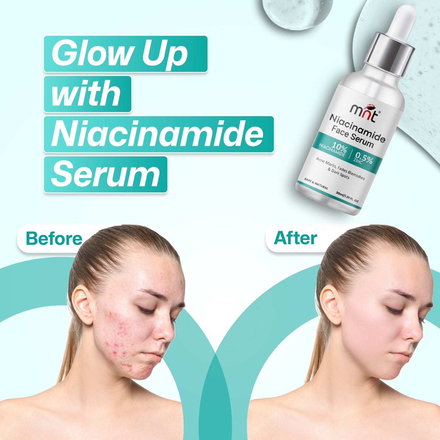 MNT 10% Niacinamide Face Serum with 0.5% Zinc, 30ml – Targets Acne Marks, Blemishes, and Uneven Skin Tone for Clearer Skin