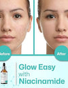 FILZA 10% Niacinamide Face Serum for Acne Marks and Dark Spots, with Zinc and Rice Extract | Fades Blemishes, Reduces Hyperpigmentation & Balances Oil | 30 ml