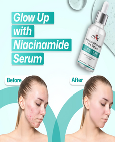 Reveal Clearer Skin with MNT 10% Niacinamide Face Serum with 0.5% Zinc – Your Solution for Acne Marks, Blemishes, and Uneven Skin Tone