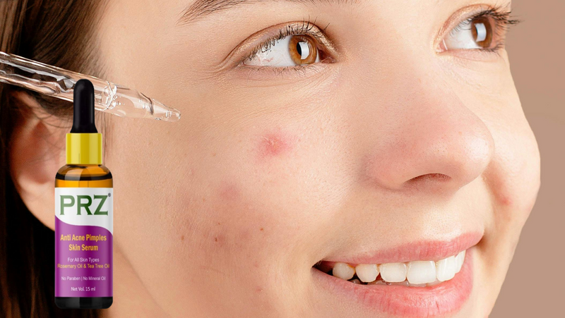 PRZ Anti-Acne Serum: Say Goodbye to Pimples & Dark Spots