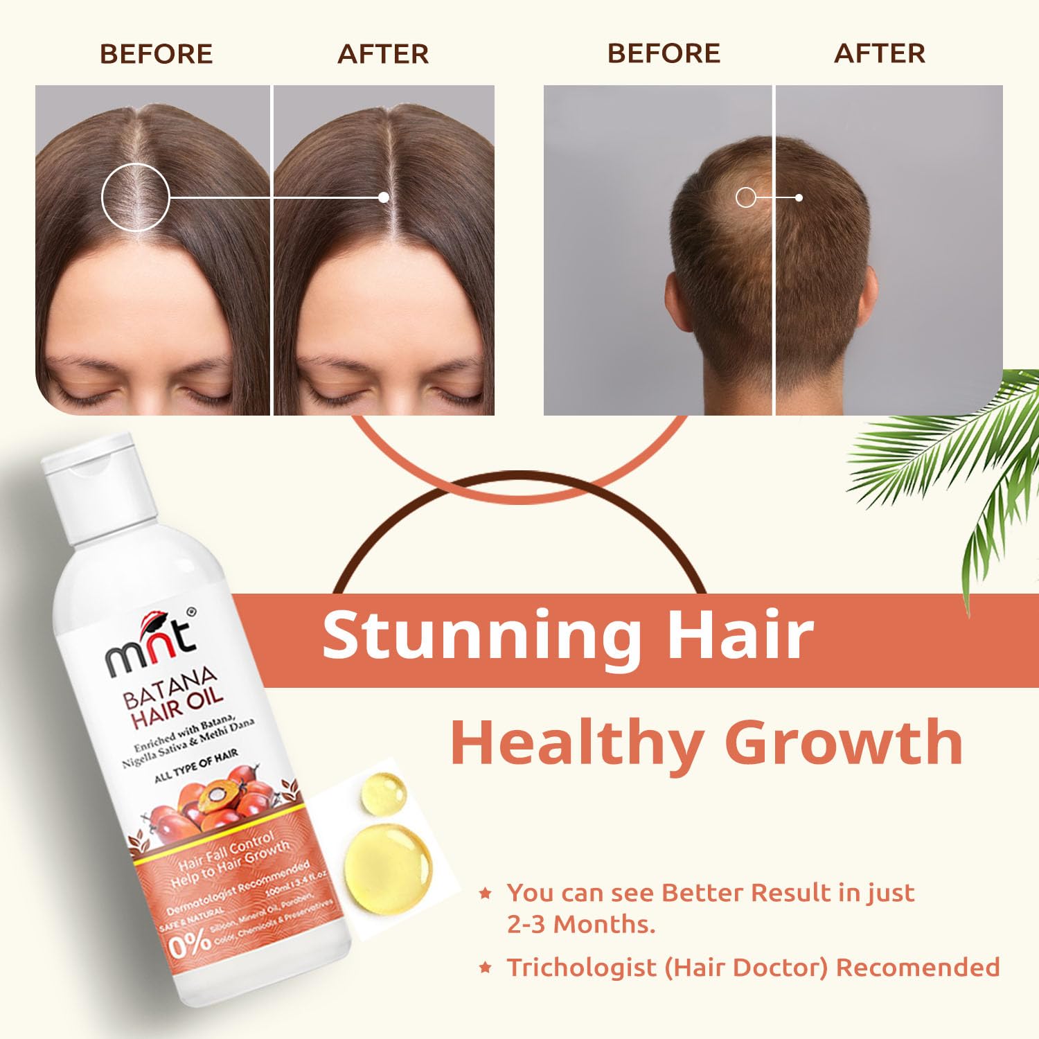 MNT Batana Oil for Hair Growth with Methi Dana & Curry Leaf | Promotes Thicker, Shiny, Stronger & Healthy Hair | Pure Batana Oil for Hair Growth and Hair Fall Control | 100 ml