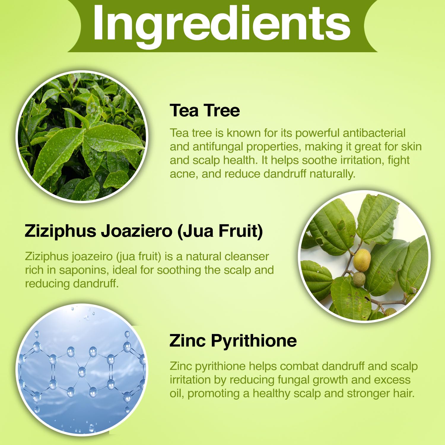 MNT Tea Tree Anti-Dandruff Scalp Serum 100ml – Natural Treatment for Flaky, Itchy Scalp, Soothes, Nourishes, and Reduces Dandruff