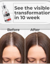 MNT Advanced Hair Growth Serum with 2% Lindera Strychnifolia 3% Redensyl, 4% Anagain, 2% Procapil | Hair Growth Serum for Scalp | Hair Growth Serum for Women & Men | 30 ml