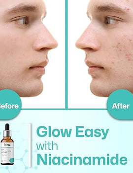 FILZA 10% Niacinamide Face Serum for Acne Marks and Dark Spots, with Zinc and Rice Extract | Fades Blemishes, Reduces Hyperpigmentation & Balances Oil | 30 ml